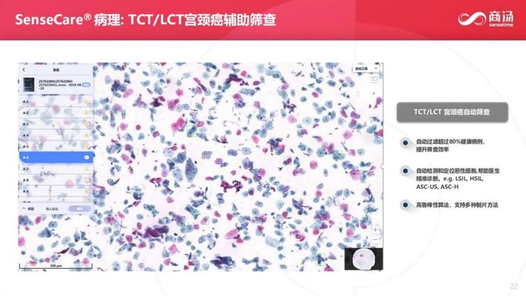 医疗设备销售经验心得_一个医疗器械销售心得_销售医疗设备的工作总结