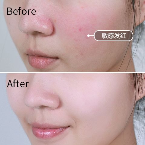 护肤心得十年经验怎么写_十年护肤经验护肤心得_护肤经验分享心得