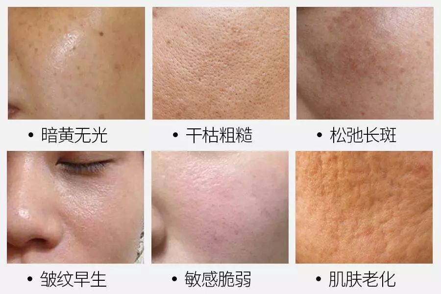 十年护肤经验护肤心得_护肤心得十年经验怎么写_护肤经验分享心得