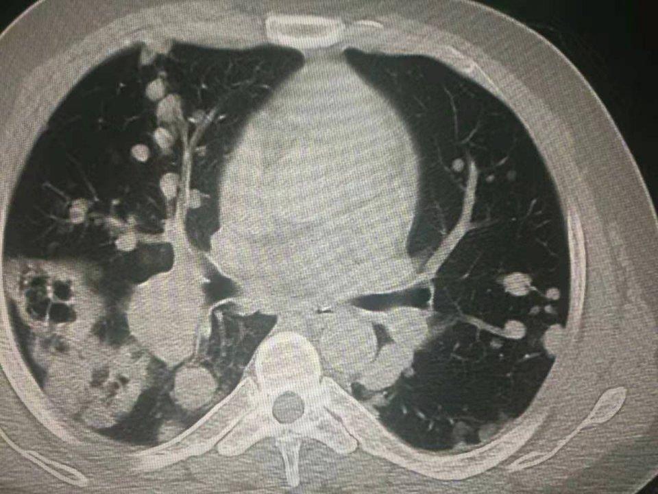 养鸽子致富视频全集_鸽粪出售_致富经鸽子粪视频