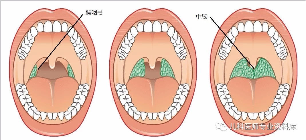 蜈蚣养殖致富经_蜈蚣白养殖技术_蜈蚣养殖吧