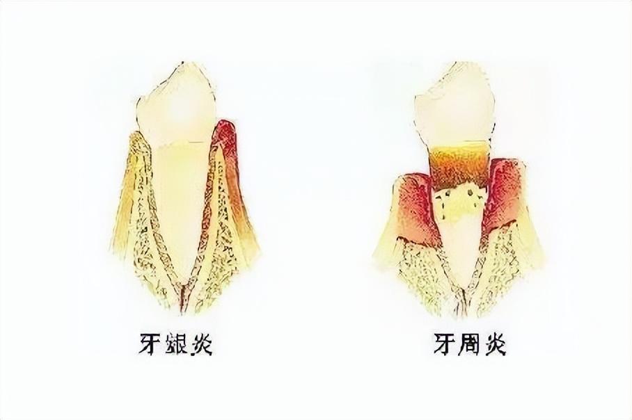 种植金属牛技术怎么样_种植金属牛技术要求_金属牛种植技术