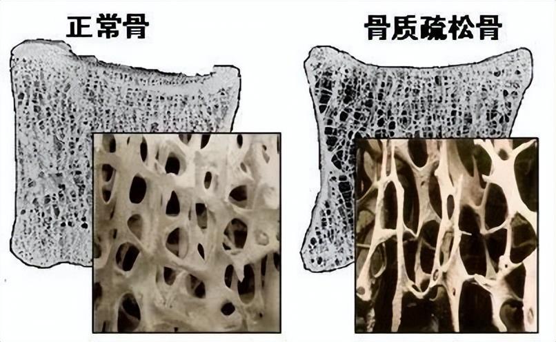 种植金属牛技术怎么样_种植金属牛技术要求_金属牛种植技术