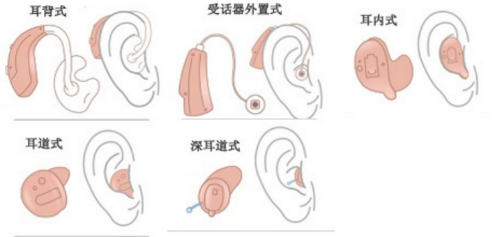 优秀规划案例_借鉴优质规划经验分享_规划的经验启示