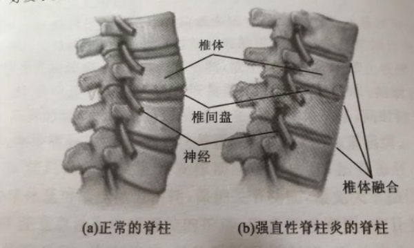 致富经之蛇_致富经之蛇_致富经之蛇