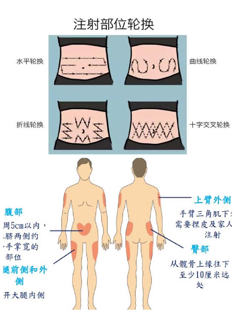 内分泌优质护理经验_优质护理经验交流发言稿_优质护理经验交流ppt