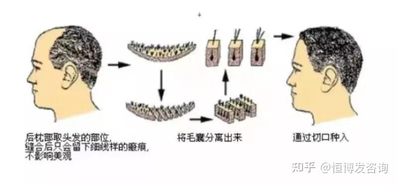 青岛种植什么农作物_青岛种植致富_青岛适合种植什么药材