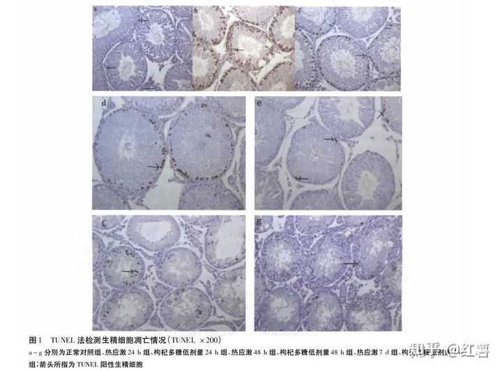 中央七致富经之枸杞_中央农业频道致富鱼_致富经枸杞种植视频