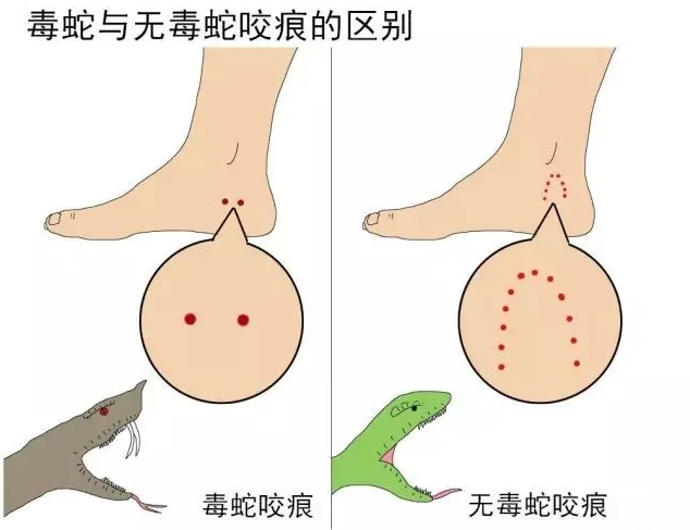 致富经蛇王姐姐险中求富_致富经蛇王姐姐_致富经之王锦蛇