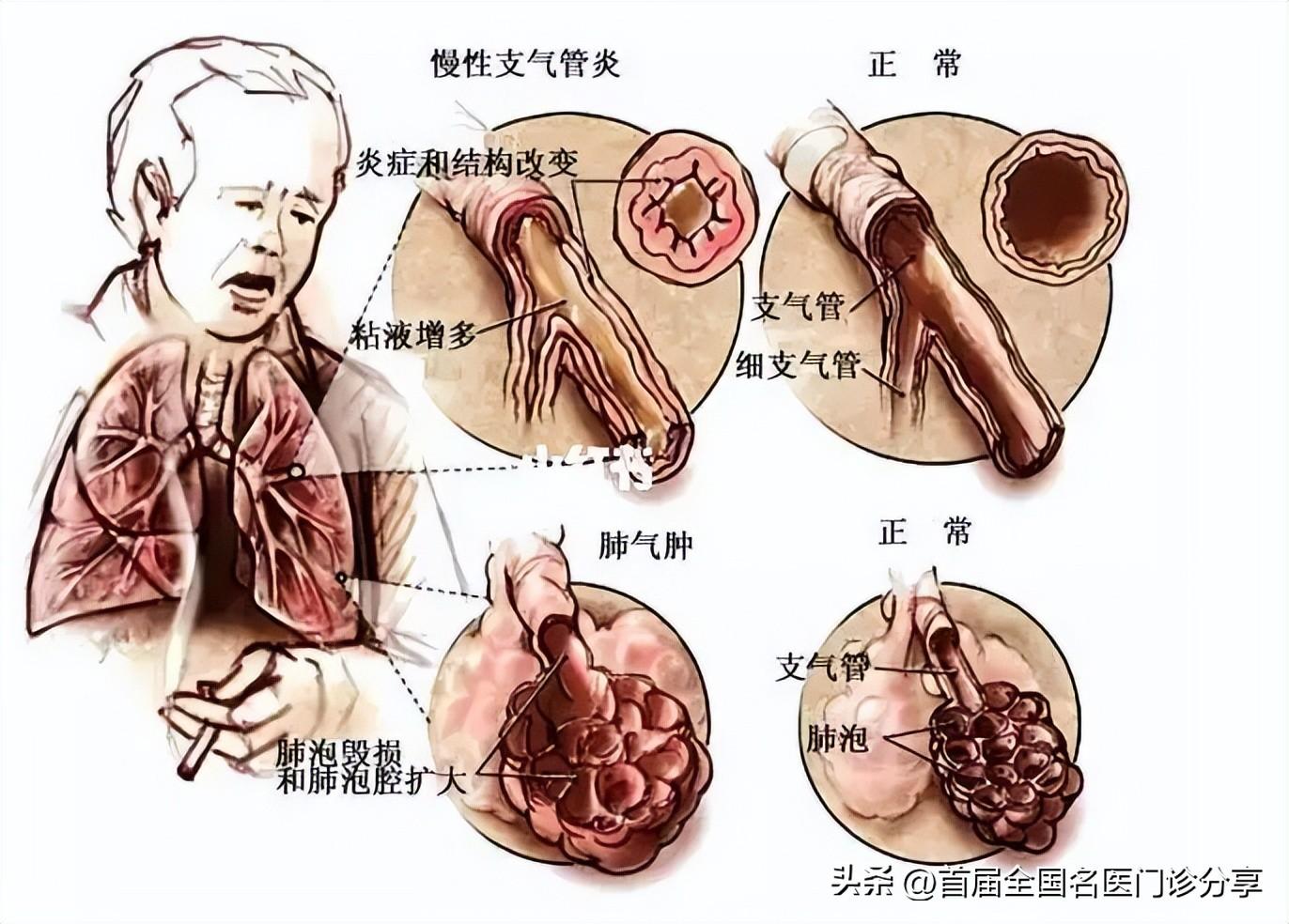 优秀经验交流材料_优秀经验交流标题大全_优质学习经验交流