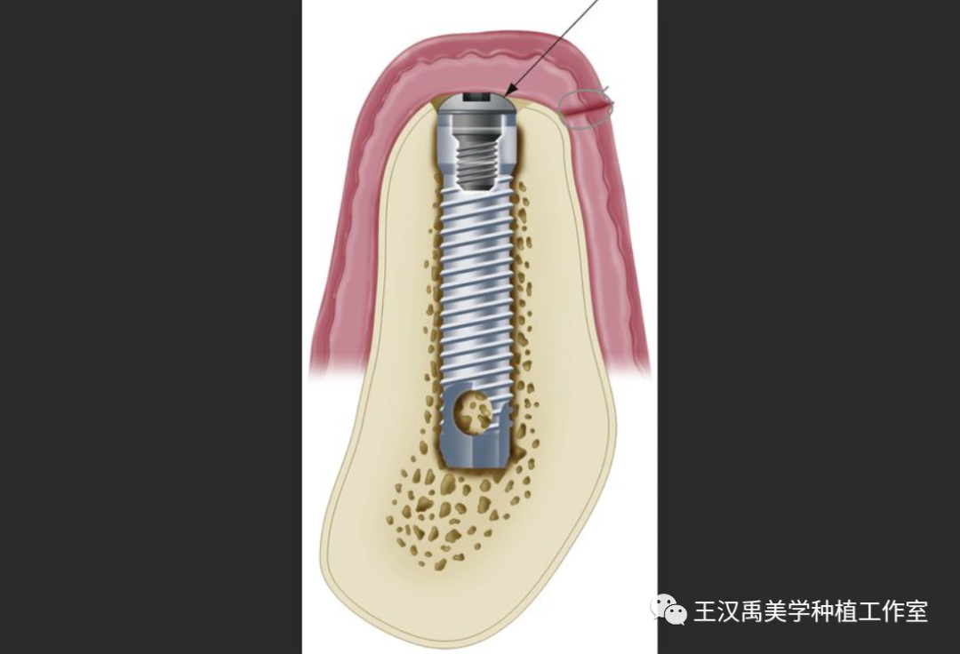 螺丝养殖技术方法_螺丝养殖技术方法视频_螺丝养殖技术